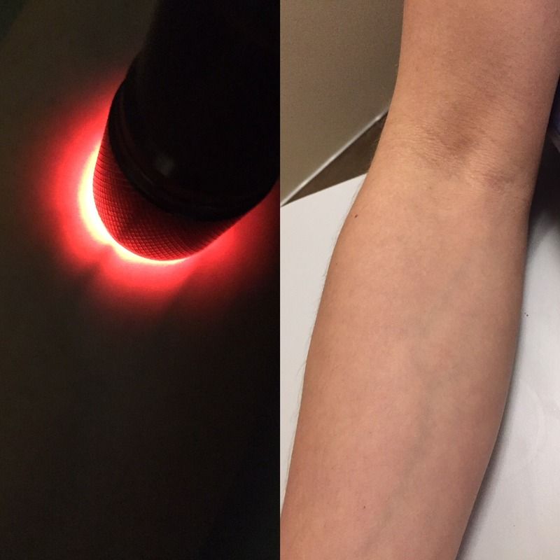 HALO Portable Red LED Light Vein Finder Transilluminator